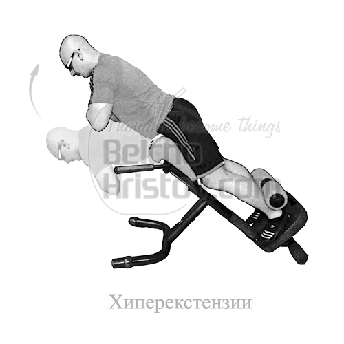 Хиперекстензия